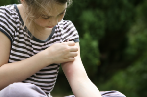 A young girl in a striped shirt examining her arm